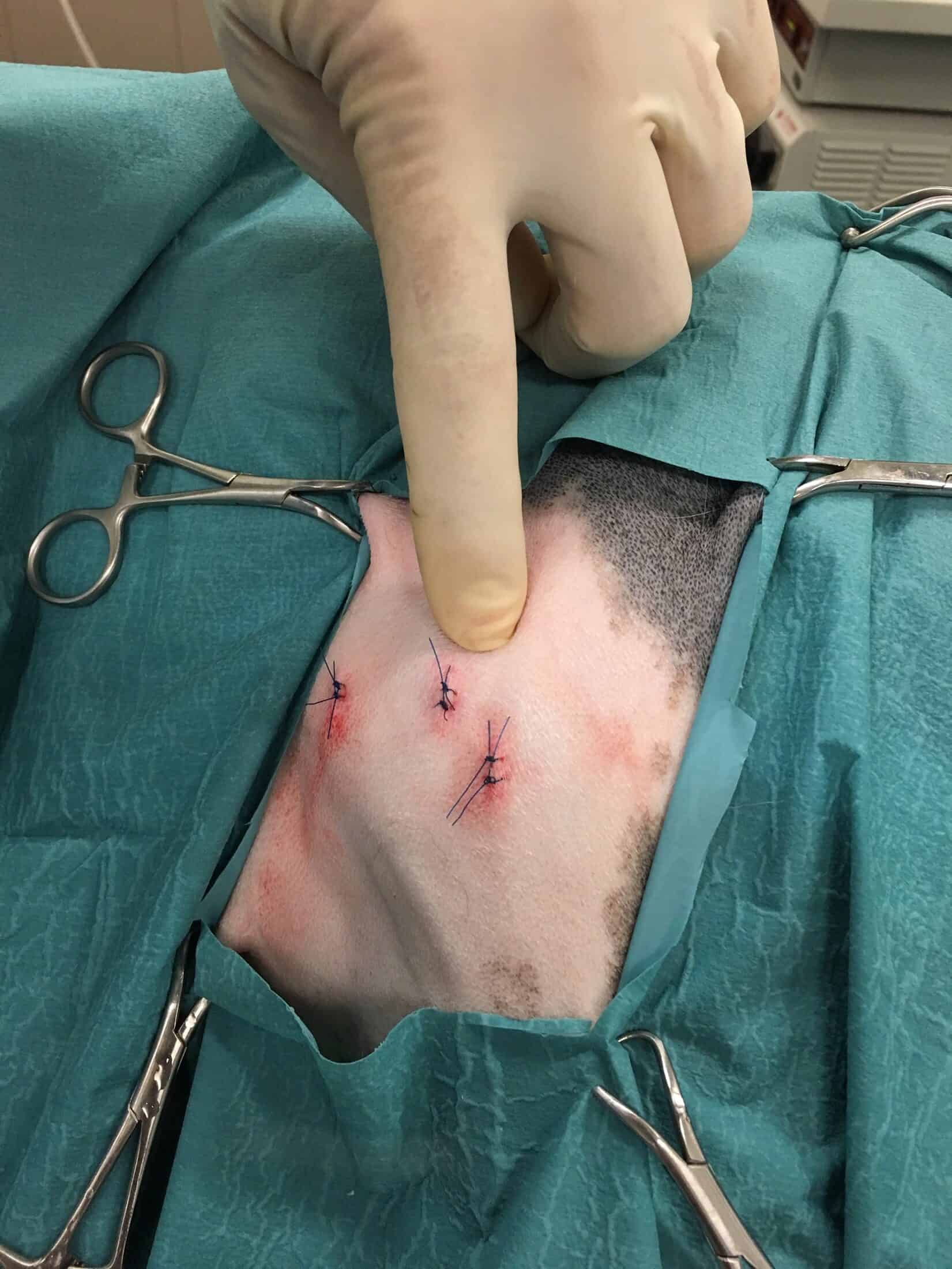 Arthroscopy skin sutures, small incisions, minimally invasive