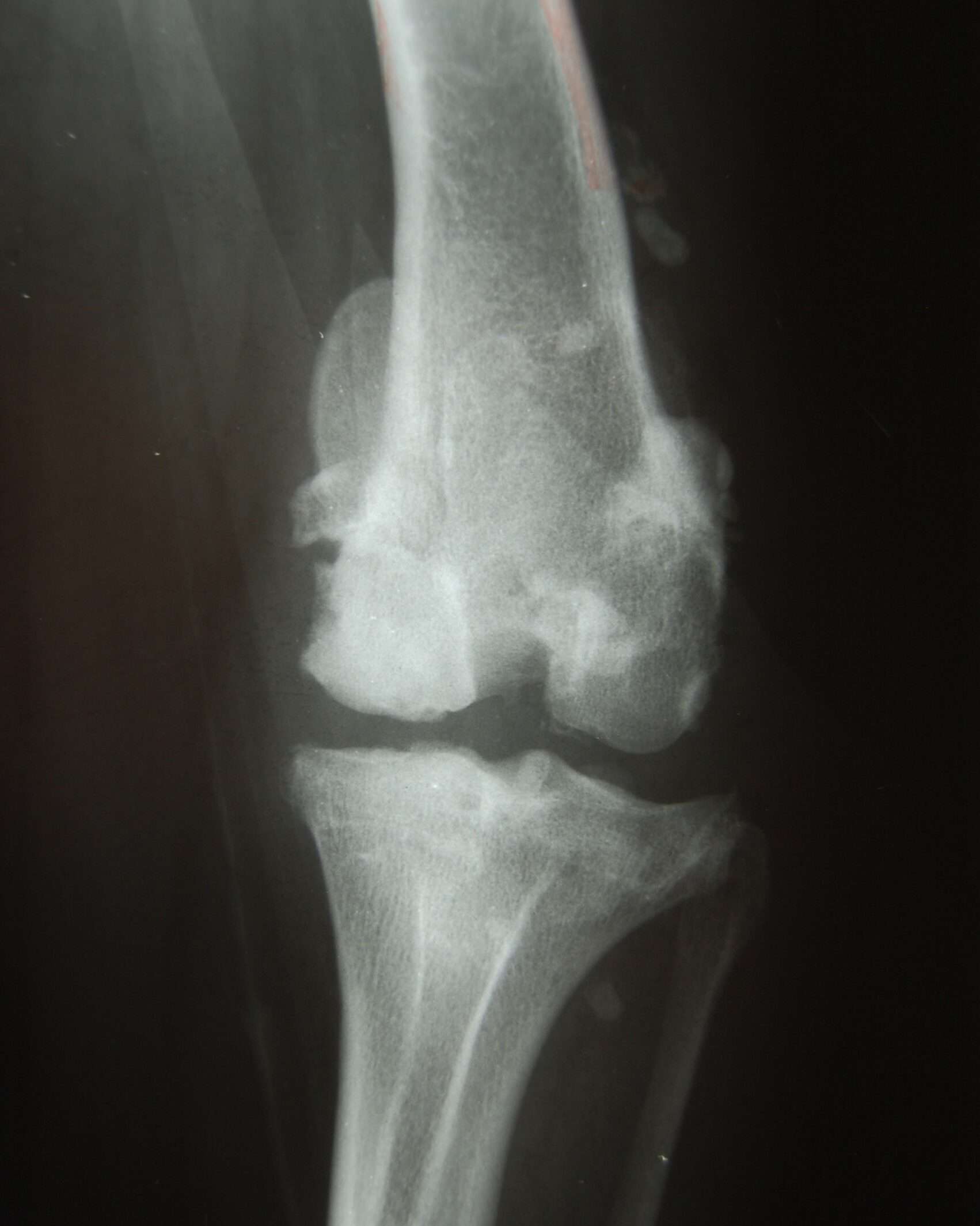 MPL X-Ray