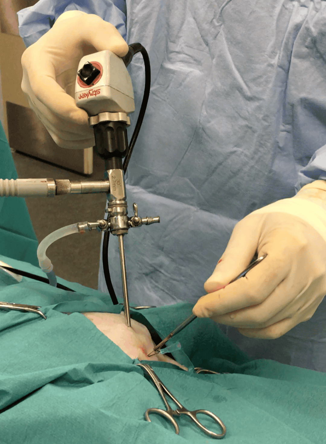 arthroscopy shoulder