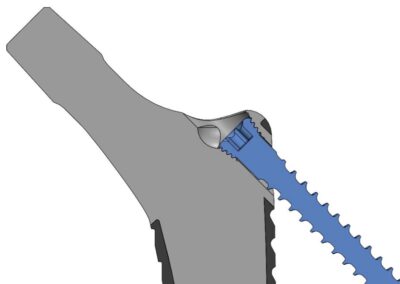 cross section of original Dingo stem screw