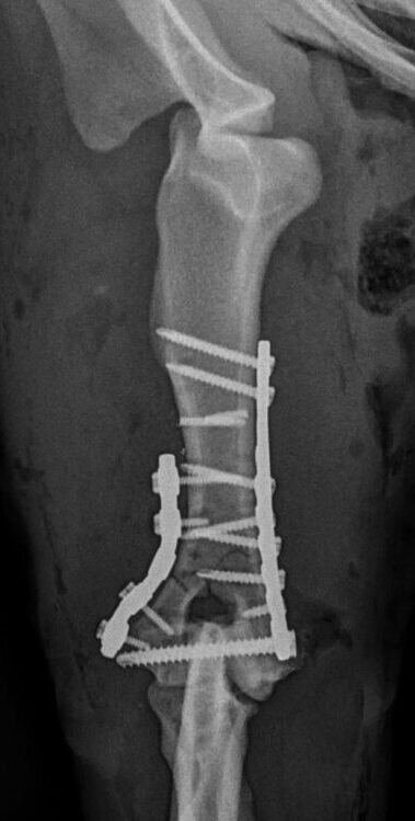 humeral # repair