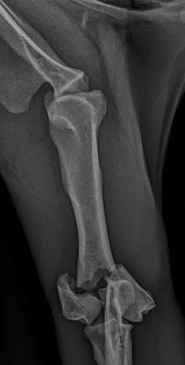 humerus fracture preop