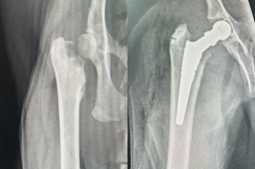 cat THR x-ray side by side