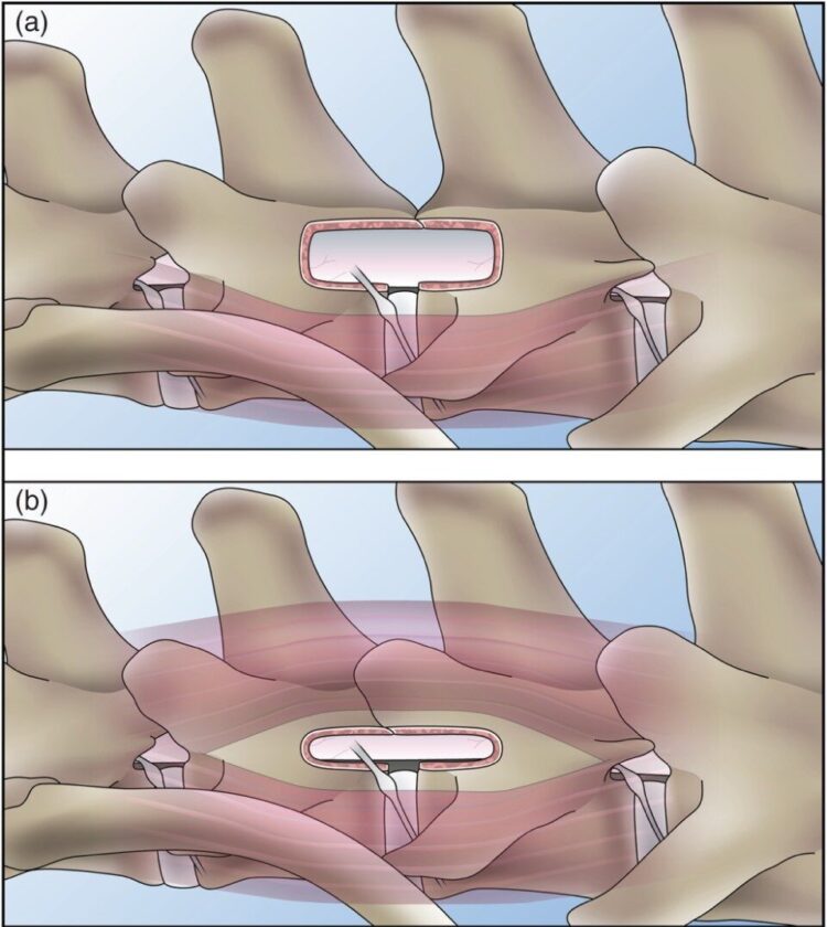 types of spinal surgery