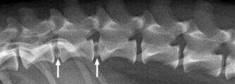 x-ray spine 2